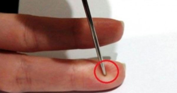 Featured Image for Δείτε ΤΙ πρέπει να κάνετε σε έναν άνθρωπο που παθαίνει εγκεφαλικό επεισόδιο για να του σώσετε τη ζωή