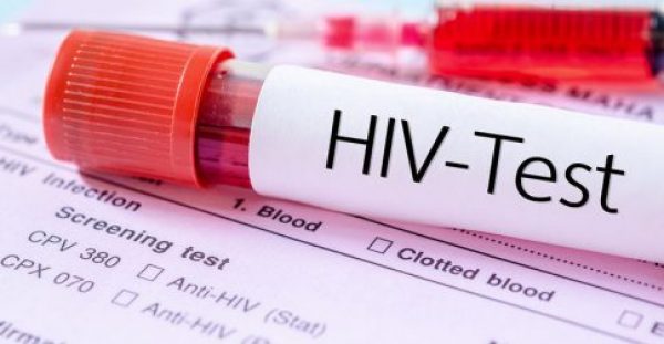 Ένα νέο αντίσωμα δίνει ελπίδες για ενισχυμένη θεραπεία του ιού HIV