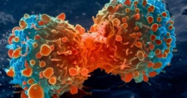Τέλος οι χημειοθεραπείες: Αυτή είναι η νέα μέθοδος καταπολέμησης του καρκίνου!