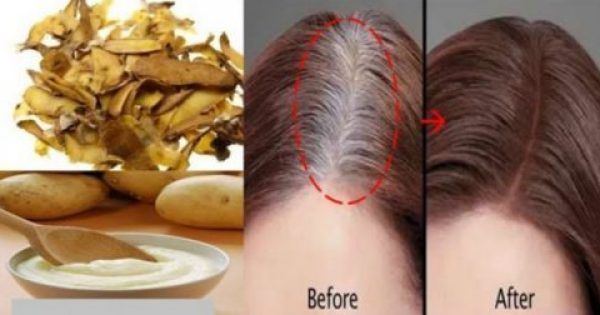 Η λύση σε ένα από τα μεγαλύτερα προβλήματα των γυναικών! Καλύψτε φυσικά τα γκρίζα μαλλιά με την βοήθεια της πατάτας!