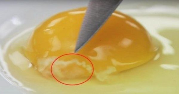 Πόσο επικίνδυνο είναι αυτό στο αυγό, αν το δείτε;