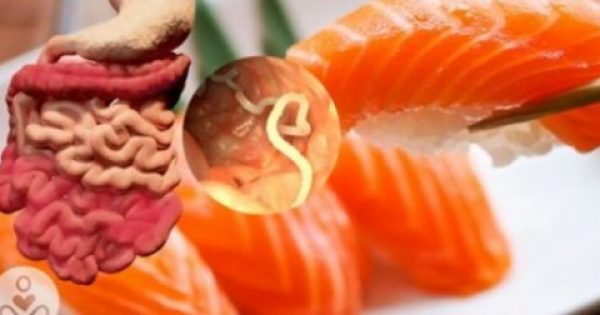 Τρώτε σούσι; Οι γιατροί προειδοποιούν