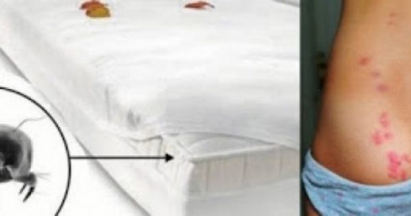 Πώς να καθαρίσετε το στρώμα του κρεβατιού σας! Απαλλαγείτε από τα ακάρεα