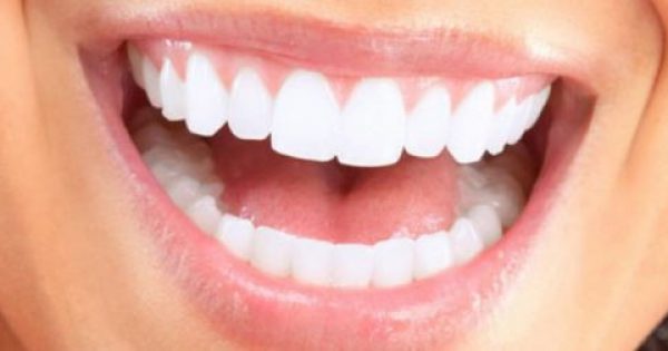 Πώς θα προλάβετε την τερηδόνα στα δόντια;