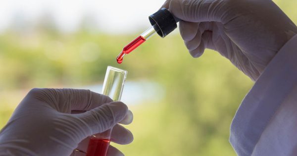 Αναπτύχθηκε το πρώτο τεστ αίματος που προβλέπει την εμφάνιση και εξέλιξη της νόσου Χάντινγκτον