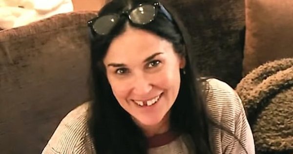 Featured Image for Η Demi Moore είπε ότι έχασε δόντια εξαιτίας αυξημένου στρες – Τι της… απαντούν οι επιστήμονες