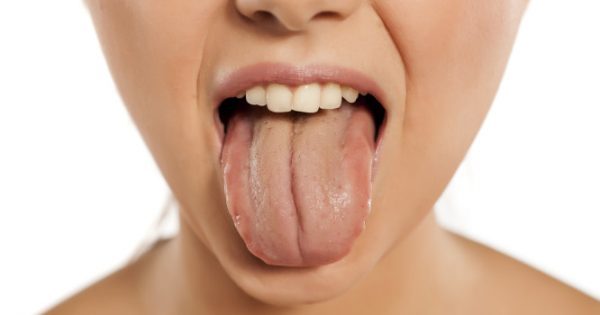 Χρώμα γλώσσας: Τι δείχνει για την υγεία σας – Ελέγξτε τη γλώσσα σας στον καθρέφτη [pics]
