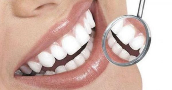Οδοντοστοιχία:Οι κακές συνήθειες και τα χειρότερα τρόφιμα που χαλάνε τα δόντια