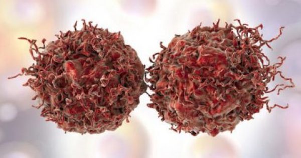 Πρωτοποριακό νέο τεστ αίματος βοηθά στη διάγνωση του καρκίνου