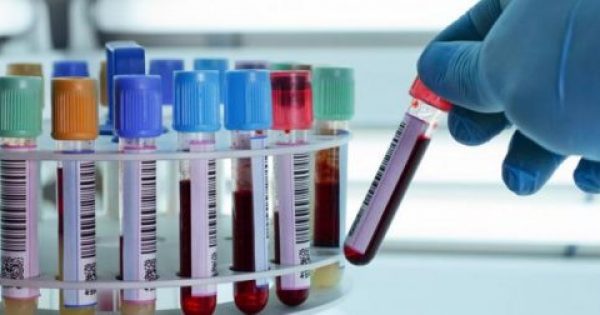 Νέο τεστ αίματος διαγνώσκει άμεσα τον καρκίνο