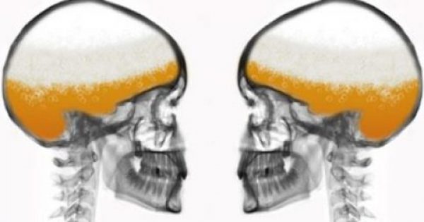2 ποτήρια μπύρας είναι πιο αποτελεσματικά για την ανακούφιση του πόνου από τη παρακεταμόλη