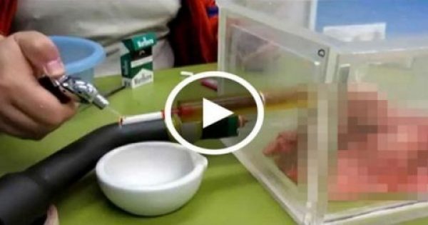 Αυτό συμβαίνει στους πνεύμονες μετά από μόλις 20 τσιγάρα (Video) Featured Image for Αυτό συμβαίνει στους πνεύμονες μετά από μόλις 20 τσιγάρα (Video)