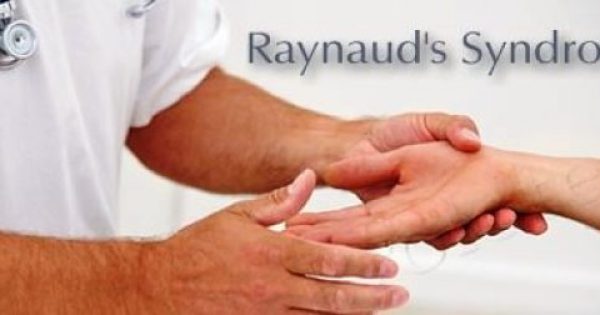 Featured Image for Raynaud:Τι είναι το φαινόμενο Raynaud