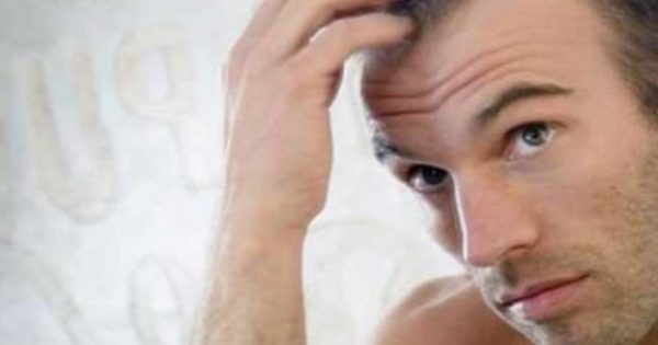 Featured Image for Τριχόπτωση και στυτική δυσλειτουργία: Πώς συνδέονται