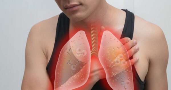 Καρκίνος του πνεύμονα και βήχας: Ποια είναι η σύνδεση;