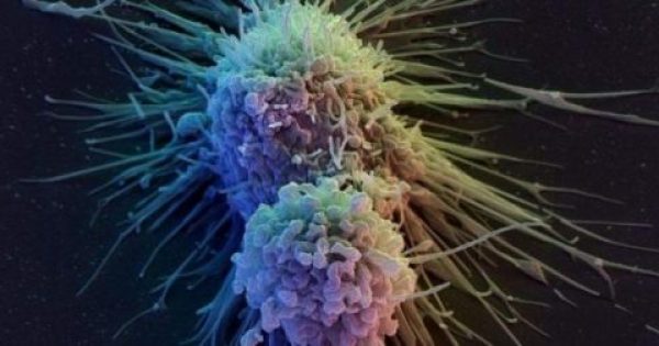 Καρκίνος του ήπατος: Τα οκτώ σημάδια ενός από τους πιο θανατηφόρους καρκίνους