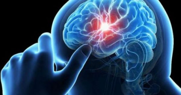 Μίνι εγκεφαλικό: Με ποια συμπτώματα χτυπάει για να το αναγνωρίσετε