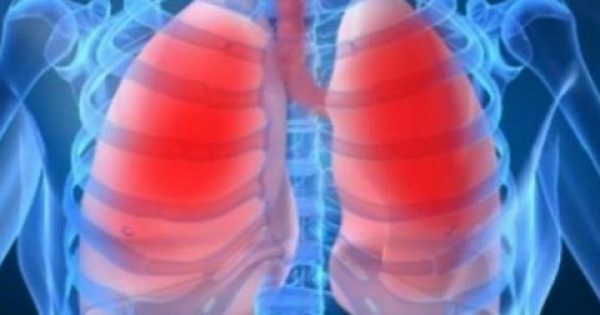 Καρκίνος του πνεύμονα: Κίνδυνος από αυξημένη πρόσληψη συγκεκριμένης βιταμίνης