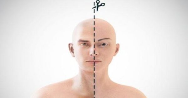 Featured Image for Συγκλονιστικό: Δημιουργούν καρκίνους οι επεμβάσεις για την αλλαγή φύλου