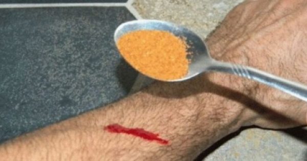 Featured Image for Δείτε ποιο μπαχαρικό (!) βάζει στο χέρι του για να σταματήσει την αιμορραγία