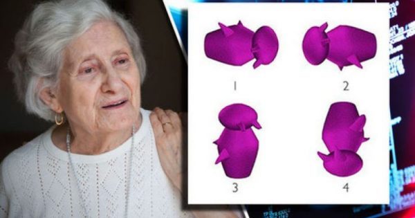 Τεστ για Αλτσχάιμερ: Βλέπετε ποιο σχήμα διαφέρει από τα άλλα; Τι λένε επιστήμονες!!!-ΒΙΝΤΕΟ