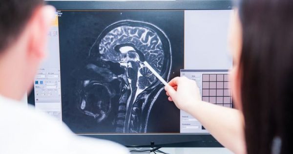 Έρευνα: Η σχιζοφρένεια διαταράσσει όλο το σύστημα επικοινωνιών του εγκεφάλου!!!