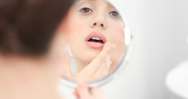 Featured Image for Έλκη στο στόμα: Απαλλαγείτε με αυτά τα 6 «γιατροσόφια»