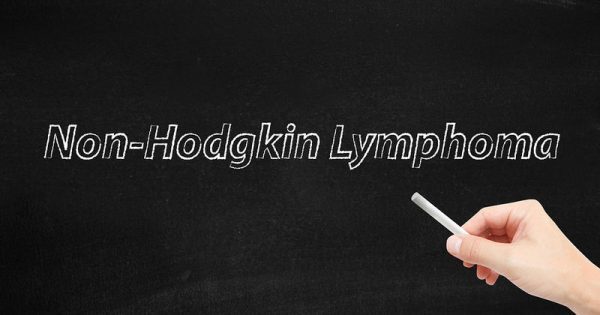 Featured Image for Μη-Hodgkin λεμφώματα: Η συχνότερη αιματολογική κακοήθεια