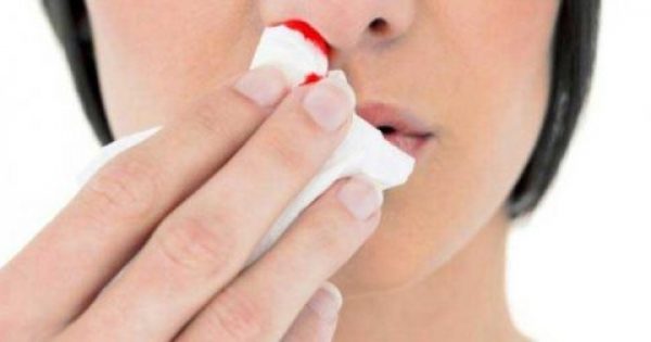 Αίμα από τη μύτη: Πως να σταματήσετε την αιμορραγία