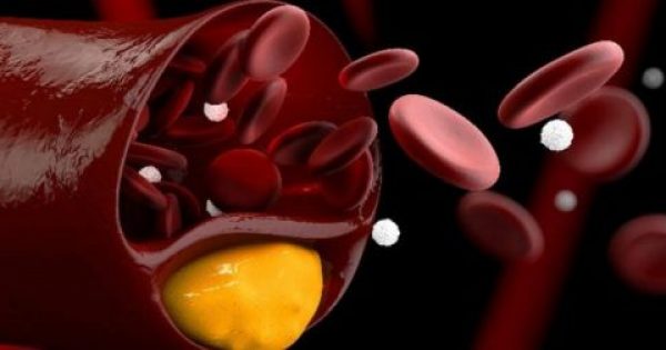 Χοληστερίνη: Ποιοι πρέπει να υποβάλλονται τακτικά σε εξέταση και ποιες οι φυσιολογικές τιμές