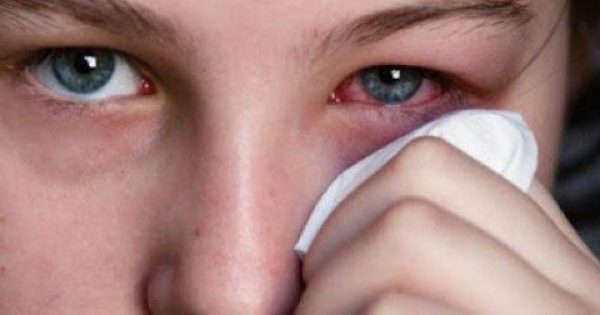 Featured Image for ΠΡΟΣΟΧΗ: Διεγνώσθη με καρκίνο στα μάτια. Η αιτία που τον προκάλεσε; Κάτι που κάνουμε κάθε βράδυ!