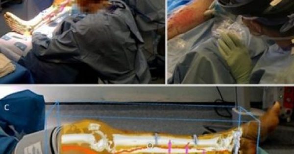 Έλληνας επιστήμονας επικεφαλής σε πρωτοποριακή χειρουργική επέμβαση – Δείτε τι εκανε!!!