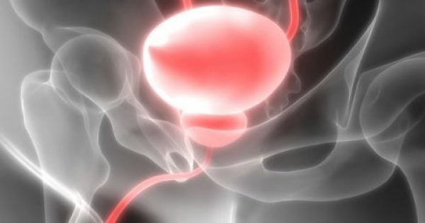Featured Image for Υπερπλασία προστάτη: Ποια είναι η λιγότερο επεμβατική χειρουργική θεραπεία;