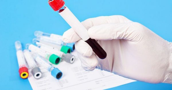 Featured Image for Υπονατριαιμία: Οι επιπτώσεις της στον εγκέφαλο!!!