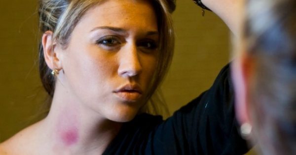 Featured Image for Πώς φεύγει η… πιπιλιά στον λαιμό