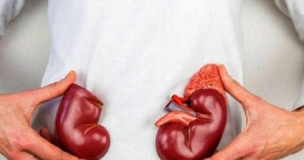 Πέτρες στα νεφρά: Οι πέντε χρυσοί κανόνες πρόληψης