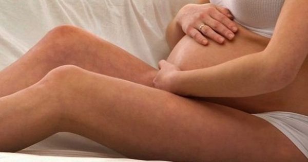 Απαραίτητη η θεραπεία των κιρσών πριν την εγκυμοσύνη; Ή όχι;