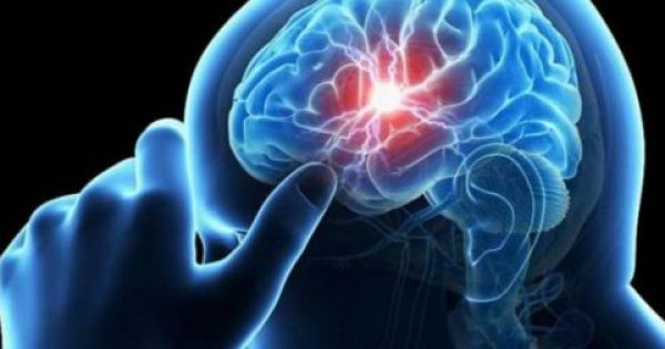 Ανεύρυσμα εγκεφάλου: Τα συμπτώματα που θα πρέπει να μας ανησυχήσουν