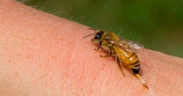 Σας τσίμπησε μέλισσα; Δείτε τι πρέπει να κάνετε