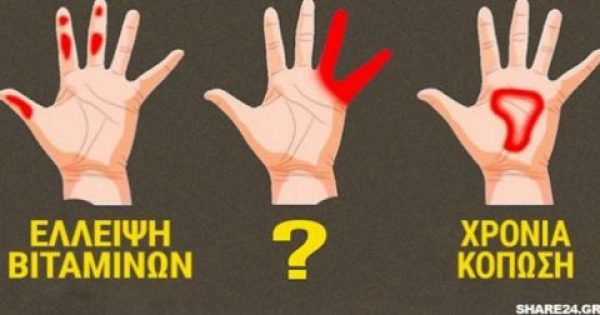 Τα Χέρια μπορούν να Προειδοποιήσουν με αυτά τα 7 Σημάδια την Υγεία μας! Κόπωση, Ανεπάρκεια Βιταμινών και Διαβήτης