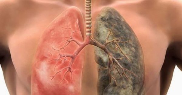 Έρευνα: Αυτές οι 6 τροφές καθαρίζουν τους πνεύμονες από τη νικοτίνη