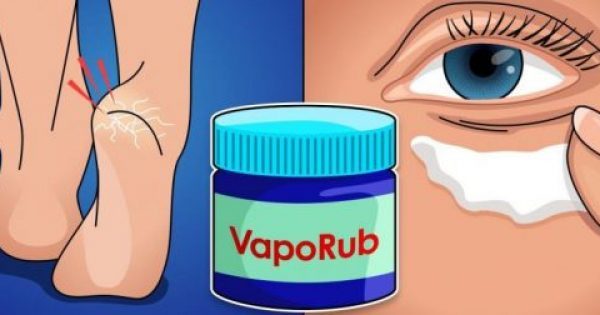 Featured Image for 14 εναλλακτικές χρήσεις του VapoRub που θα εύχεστε να γνωρίζατε νωρίτερα