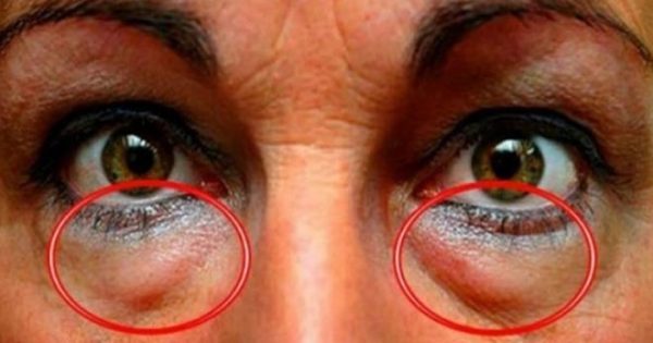 Το ελληνικό μπαχαρικό που προστατεύει τα μάτια από 90 παθήσεις