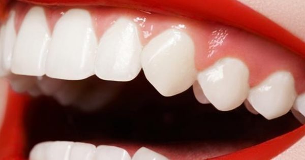 Τα προϊόντα λεύκανσης βλάπτουν τα δόντια… σε βάθος
