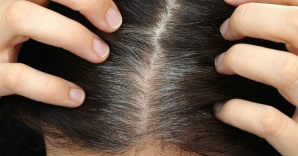 Πρόωρο γκριζάρισμα μαλλιών: 7 πιθανές αιτίες!!!