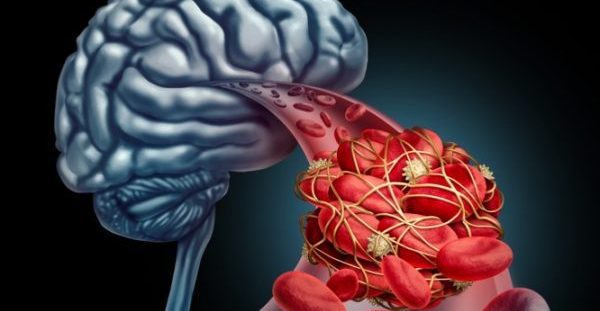 Εγκεφαλικό: Τι προσθέτουν στην ασπιρίνη, για να μειώσουν τον κίνδυνο!