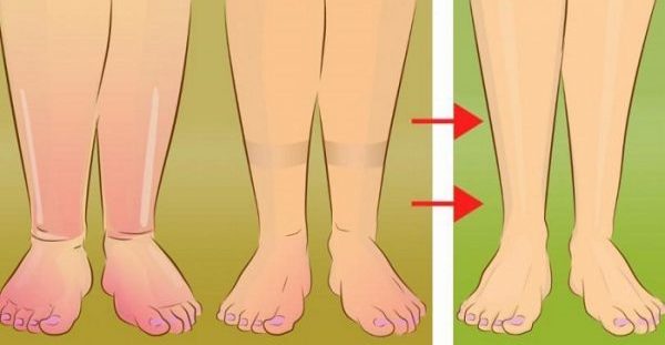 5 Πρακτικές Συμβουλές για να Ανακουφίσετε τα Πρησμένα Πόδια σας με Τρόπο Φυσικό.